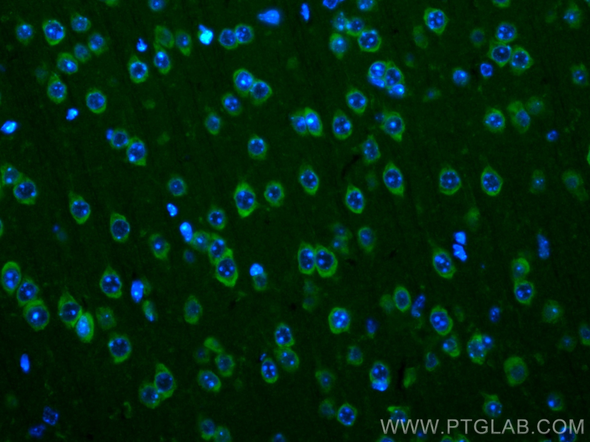 Immunofluorescence (IF) / fluorescent staining of mouse brain tissue using CoraLite® Plus 488-conjugated Ataxin 2 Polyclonal  (CL488-21776)