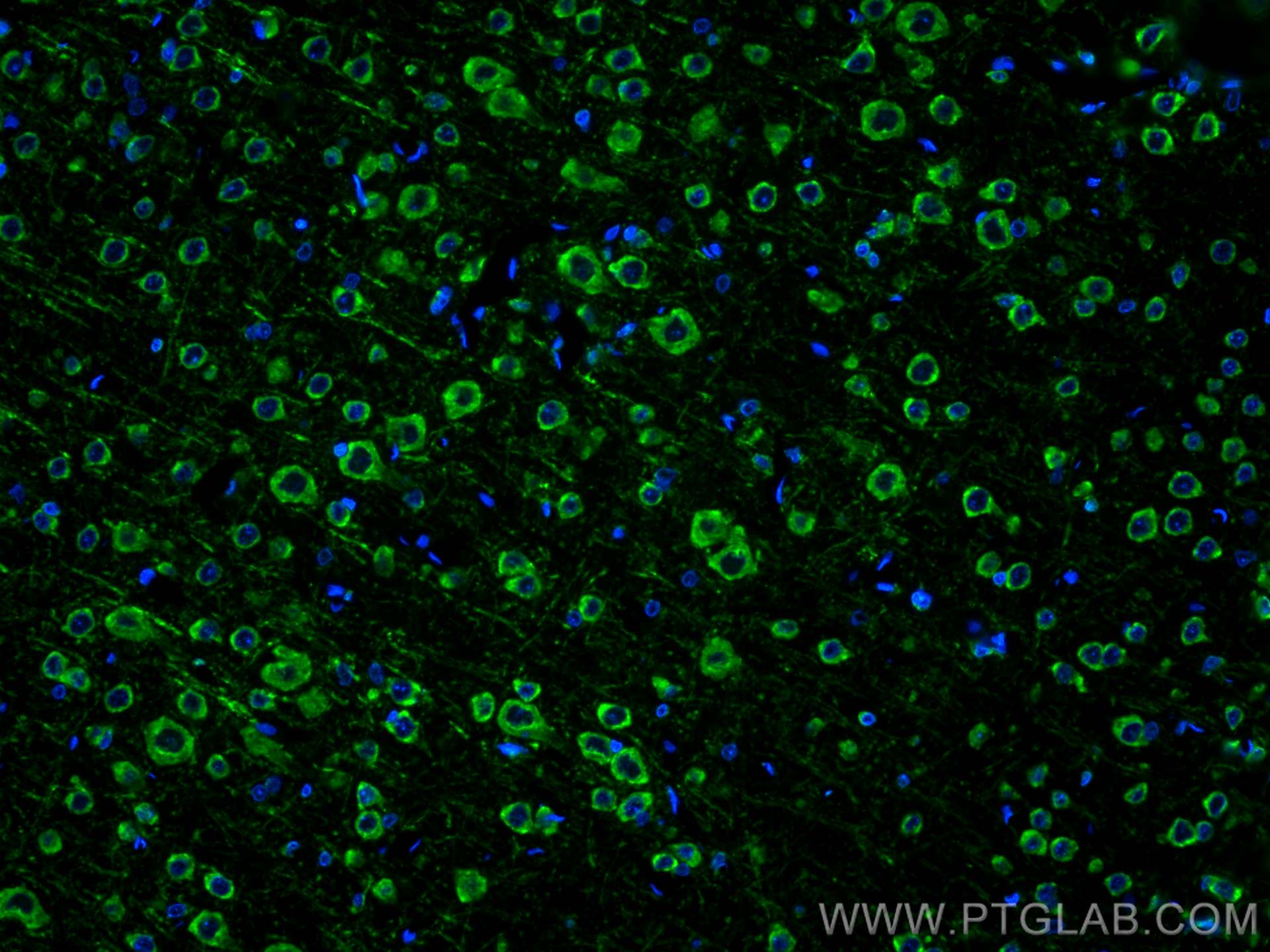 Immunofluorescence (IF) / fluorescent staining of rat brain tissue using CoraLite® Plus 488-conjugated Ataxin 2 Monoclonal  (CL488-68316)