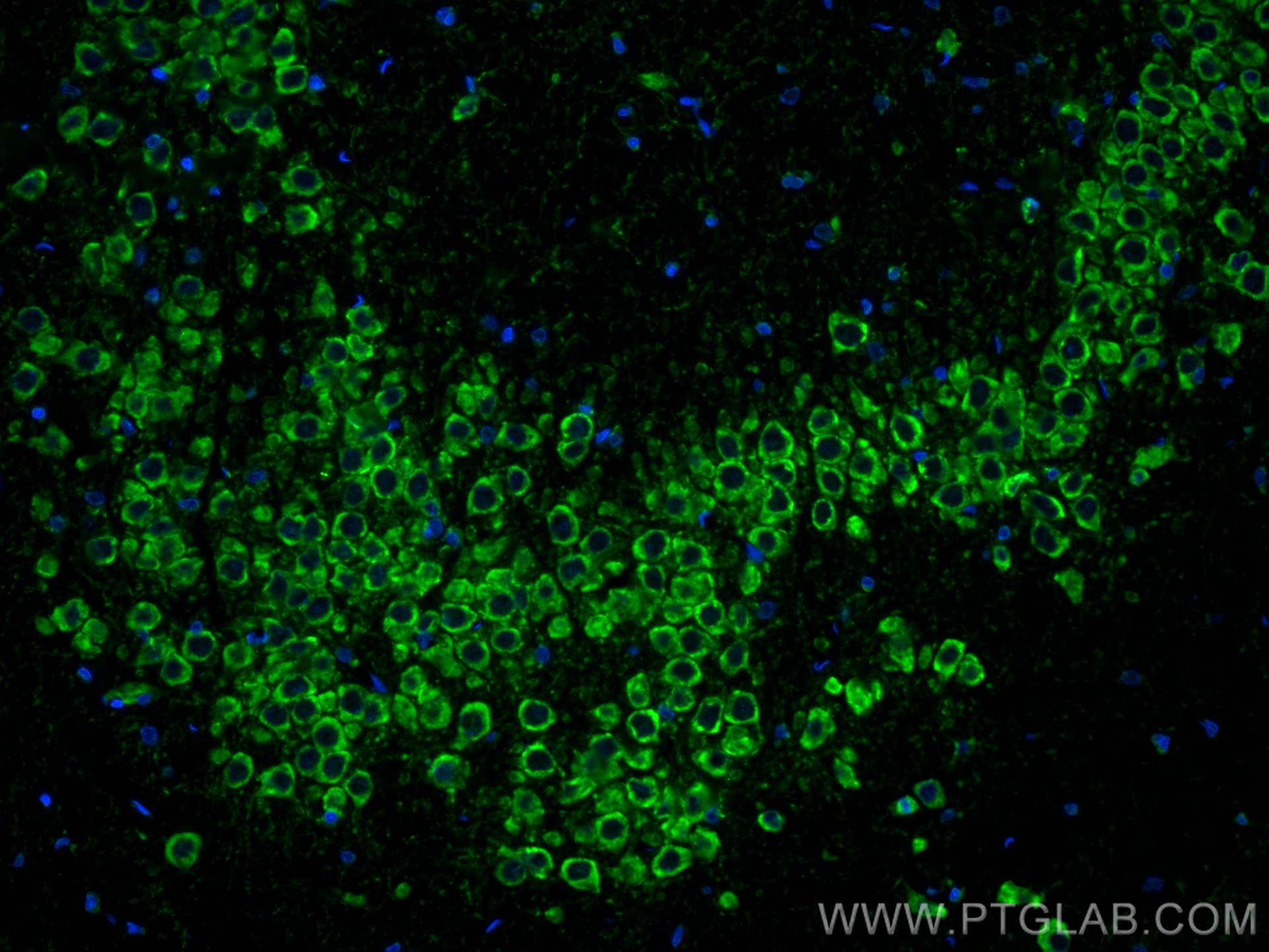 Immunofluorescence (IF) / fluorescent staining of rat brain tissue using CoraLite® Plus 488-conjugated Ataxin 2 Monoclonal  (CL488-68316)