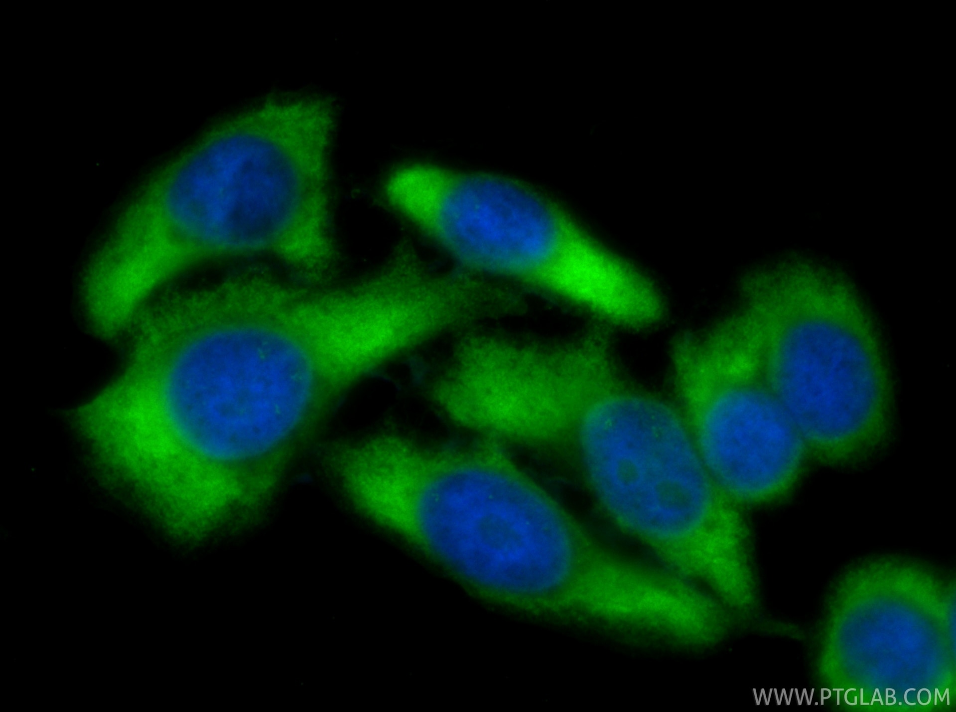 IF Staining of HepG2 using CL488-80919-2 Immunofluorescence (IF) / fluorescent staining of HepG2 cells using CoraLite® Plus 488-conjugated Ataxin 2 Recombinant (CL488-80919-2)