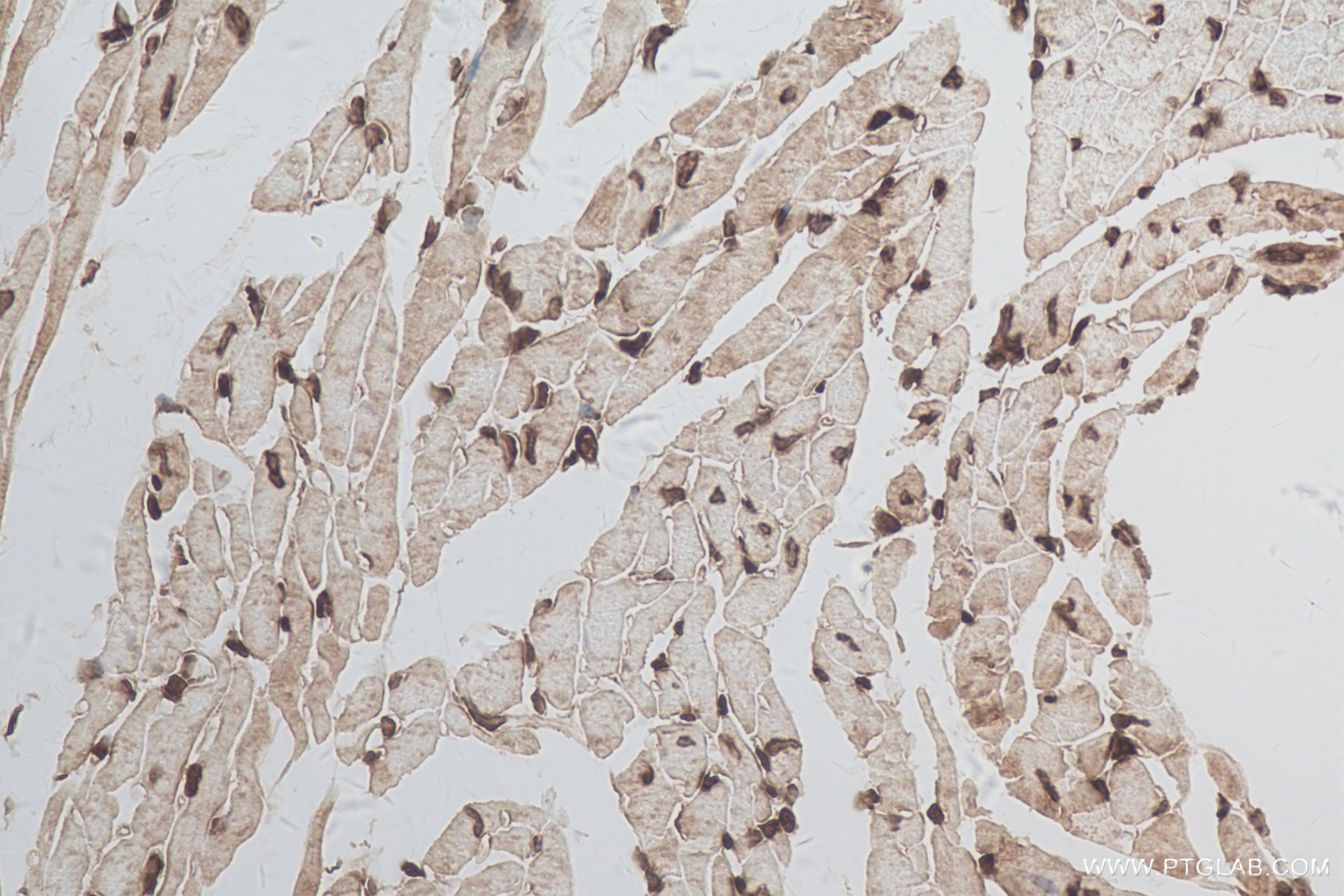 Immunohistochemistry (IHC) staining of mouse heart tissue using Atox1 Recombinant antibody (84305-1-RR)