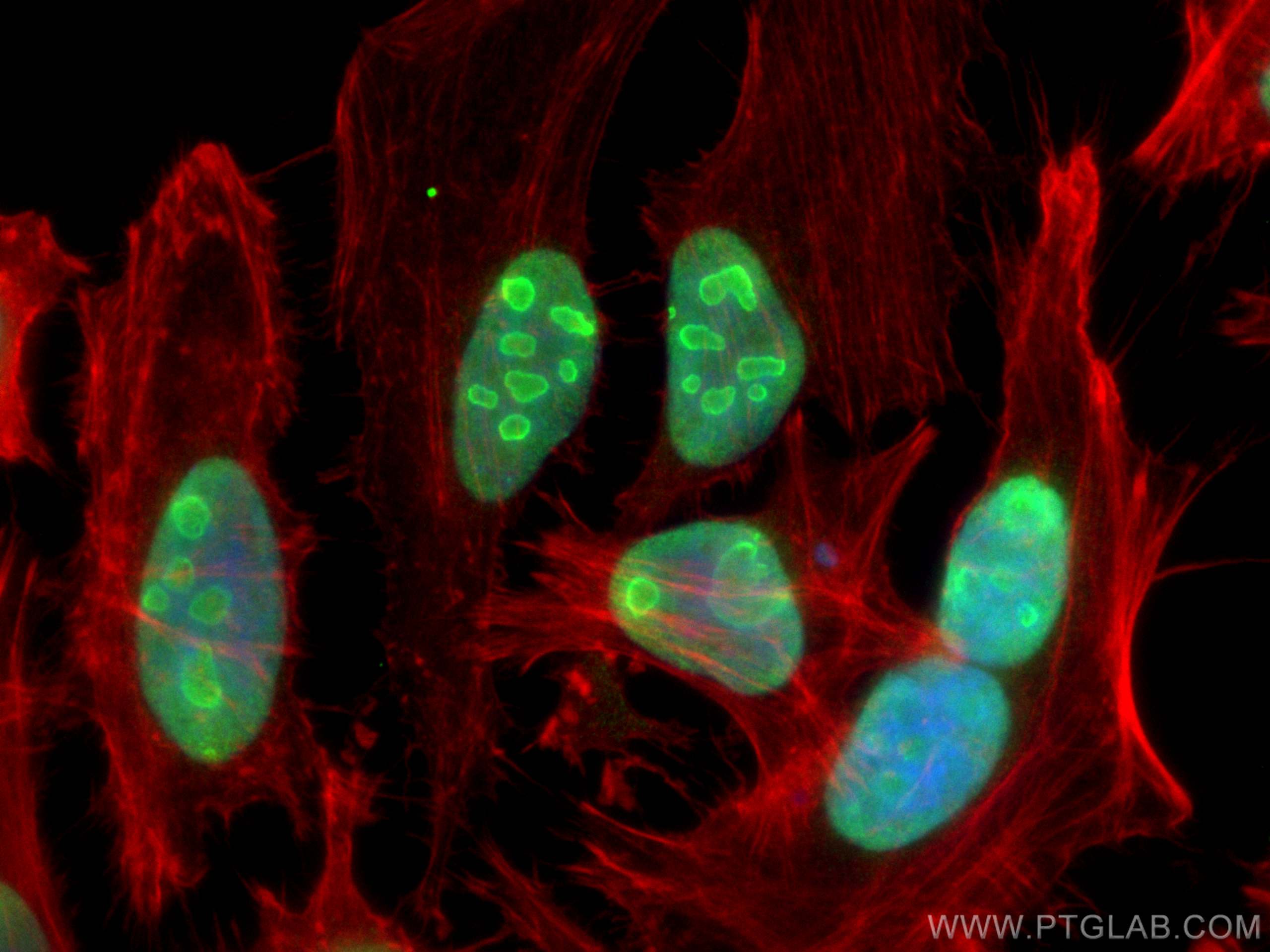 Immunofluorescence (IF) / fluorescent staining of HeLa cells using B23/NPM1 Recombinant antibody (82030-1-RR)