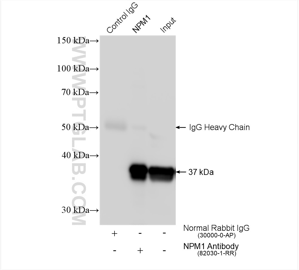 Immunoprecipitation (IP) experiment of Jurkat cells using B23/NPM1 Recombinant antibody (82030-1-RR)