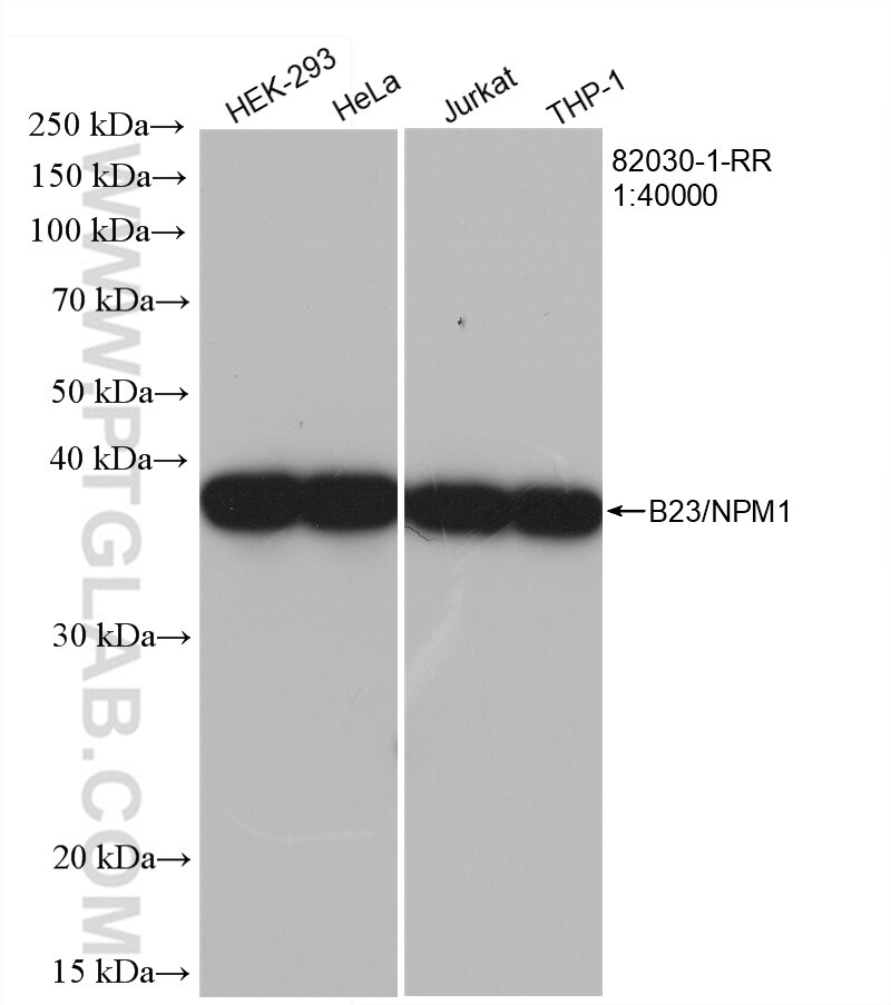 Western Blot (WB) analysis of various lysates using B23/NPM1 Recombinant antibody (82030-1-RR)