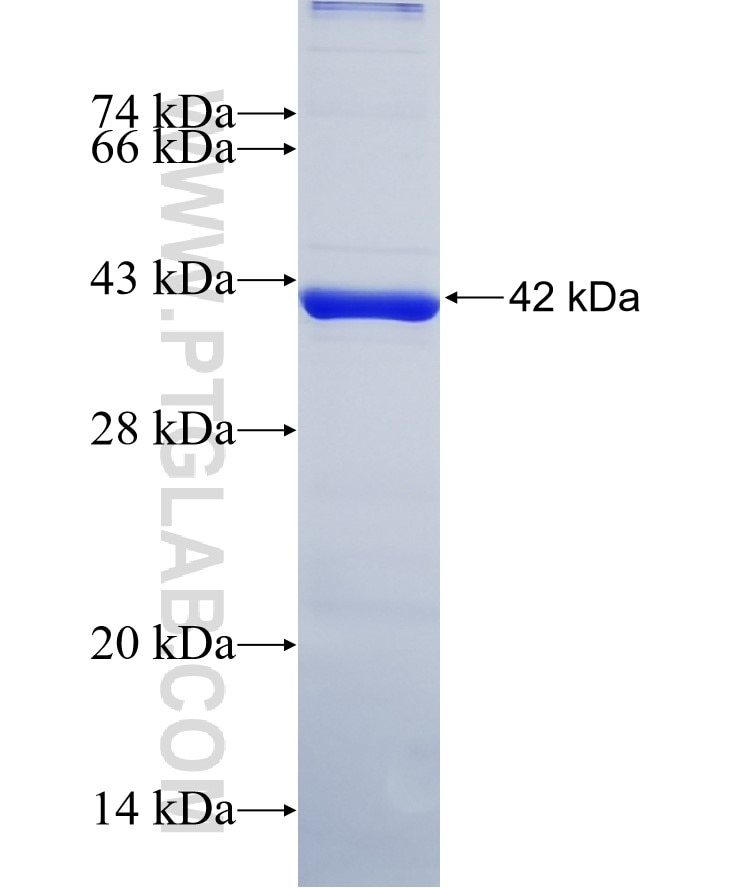 B23 fusion protein Ag7415 SDS-PAGE