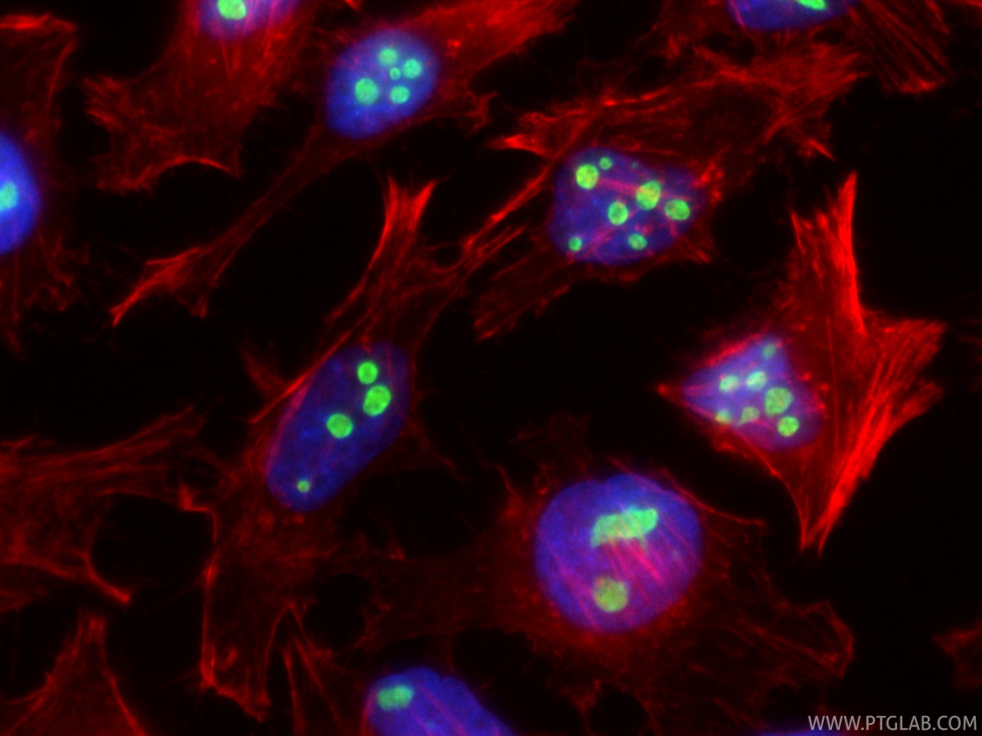 Immunofluorescence (IF) / fluorescent staining of HeLa cells using CoraLite® Plus 488-conjugated B23/NPM1 Recombinant (CL488-82030)