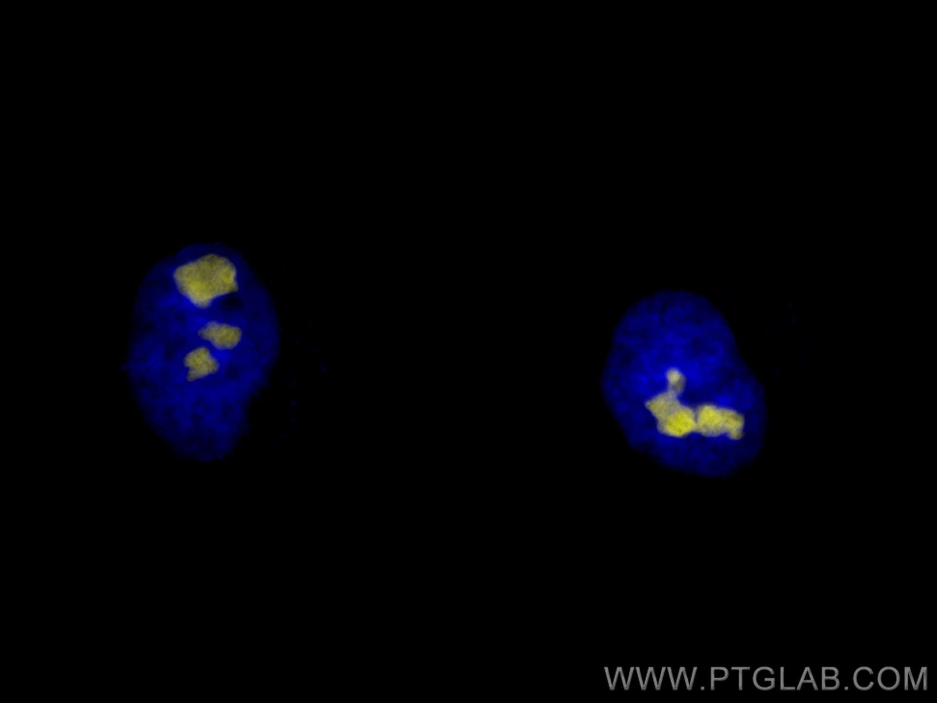 Immunofluorescence (IF) / fluorescent staining of HeLa cells using CoraLite®532-conjugated B23/NPM1 Monoclonal antibo (CL532-60096)