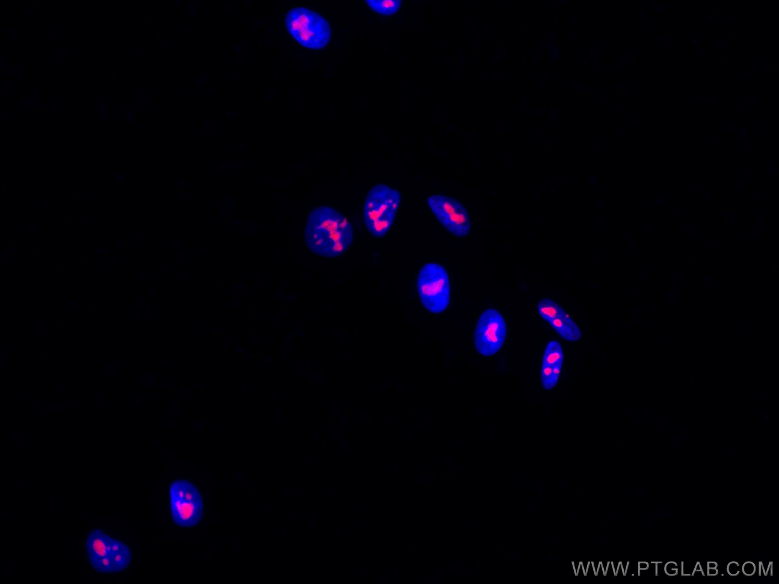 Immunofluorescence (IF) / fluorescent staining of HepG2 cells using CoraLite®555-conjugated B23/NPM1 Monoclonal antibo (CL555-60096)