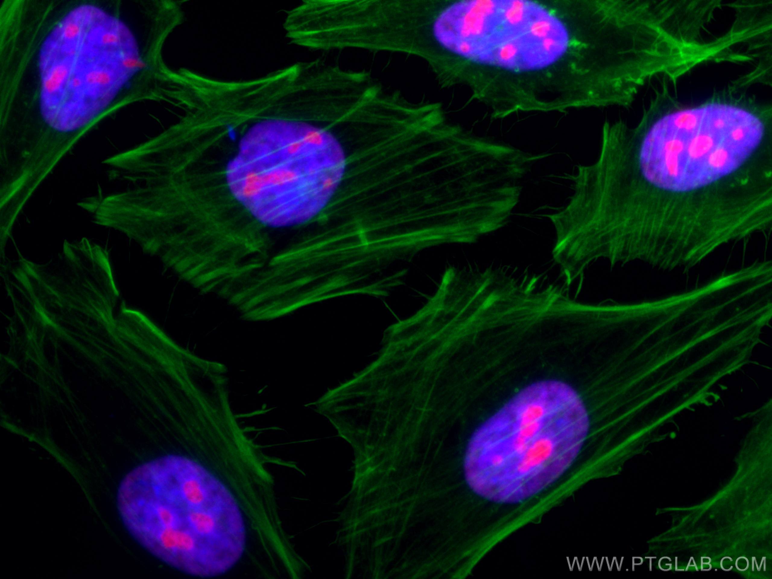 Immunofluorescence (IF) / fluorescent staining of HeLa cells using CoraLite®568-conjugated B23/NPM1 Monoclonal antibo (CL568-60096)