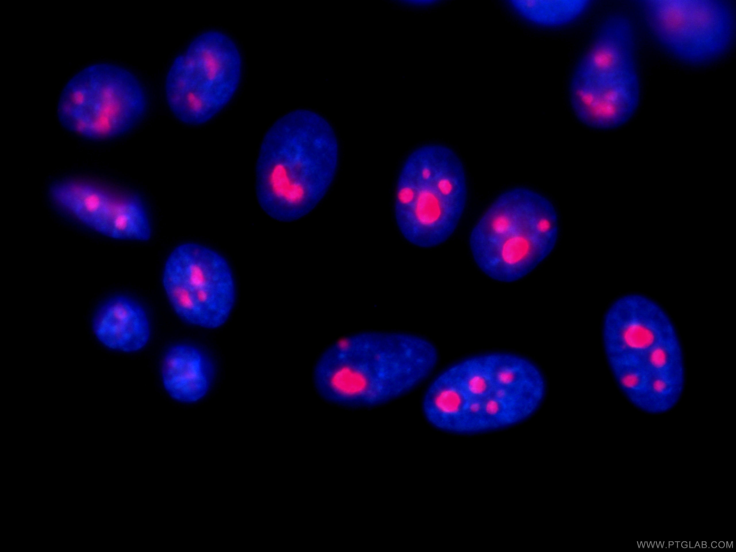 Immunofluorescence (IF) / fluorescent staining of HepG2 cells using CoraLite®594-conjugated B23/NPM1 Monoclonal antibo (CL594-60096)