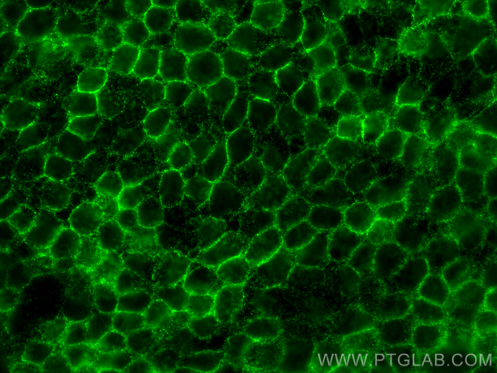 Immunofluorescence (IF) / fluorescent staining of A431 cells using Beta-2-Microglobulin Polyclonal antibody (13511-1-AP)