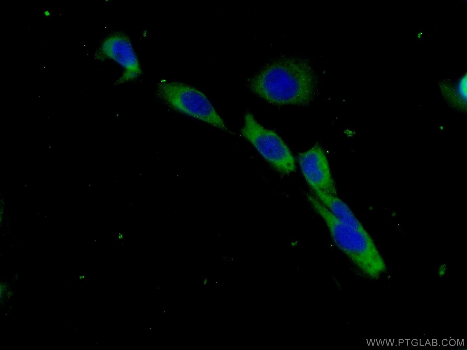 Immunofluorescence (IF) / fluorescent staining of A431 cells using Beta-2-Microglobulin Polyclonal antibody (13511-1-AP)