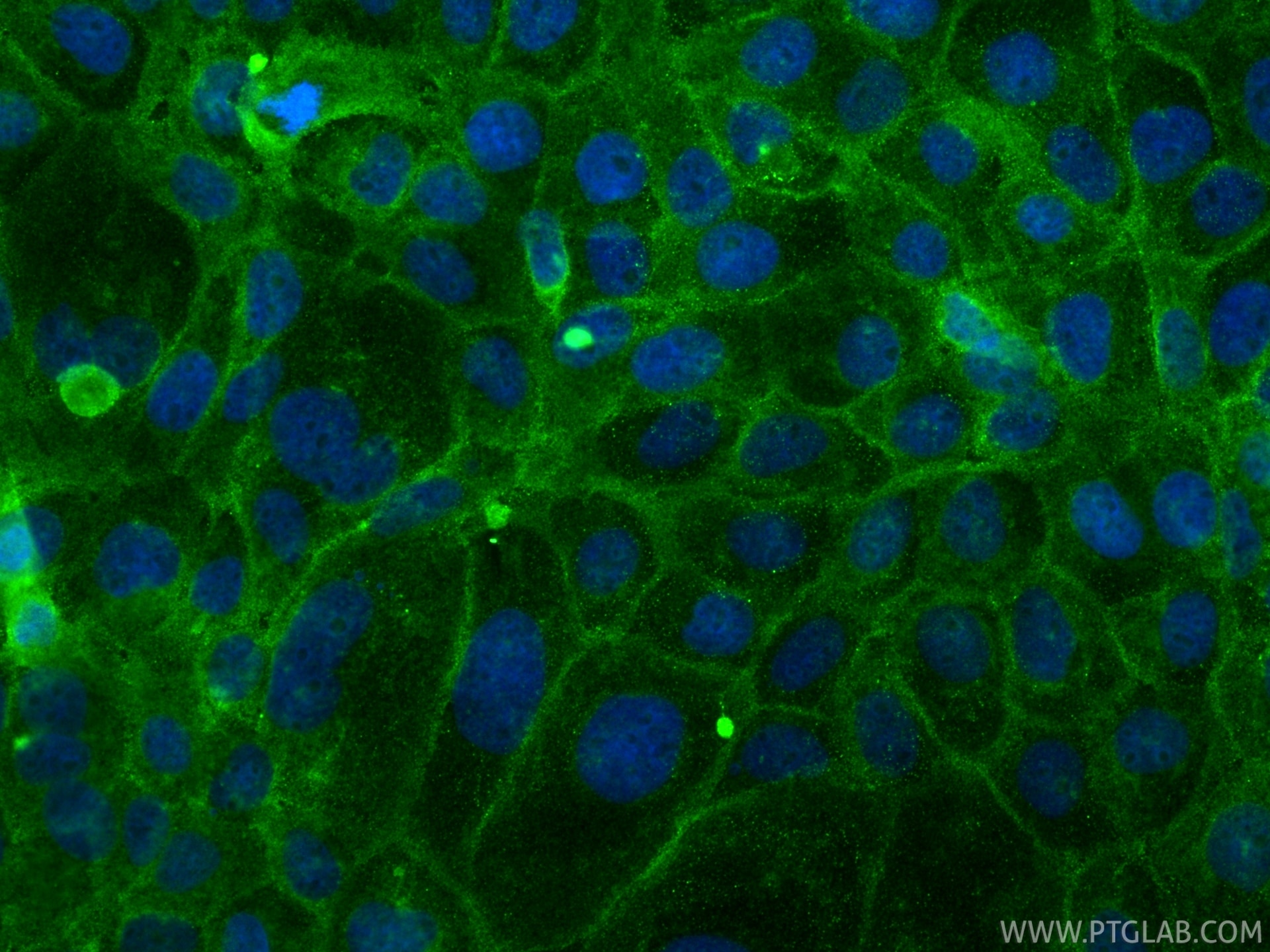 Immunofluorescence (IF) / fluorescent staining of A431 cells using Beta-2-Microglobulin Polyclonal antibody (13511-1-AP)