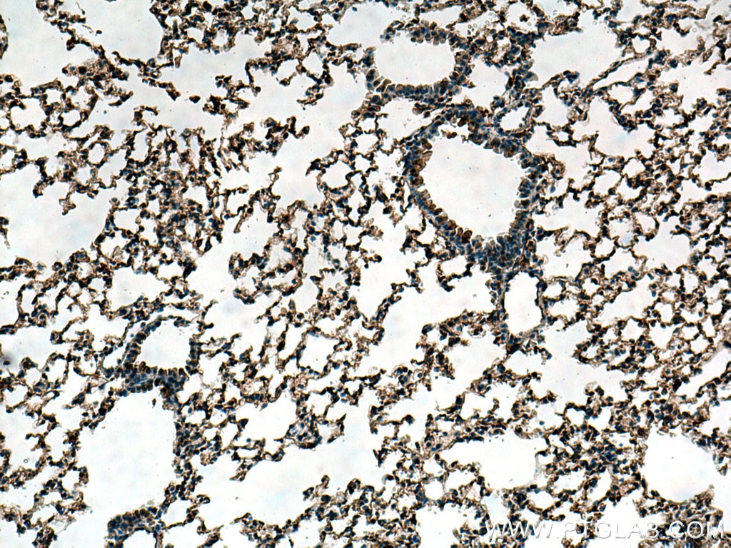 Immunohistochemistry (IHC) staining of mouse lung tissue using Beta-2-Microglobulin Polyclonal antibody (13511-1-AP)