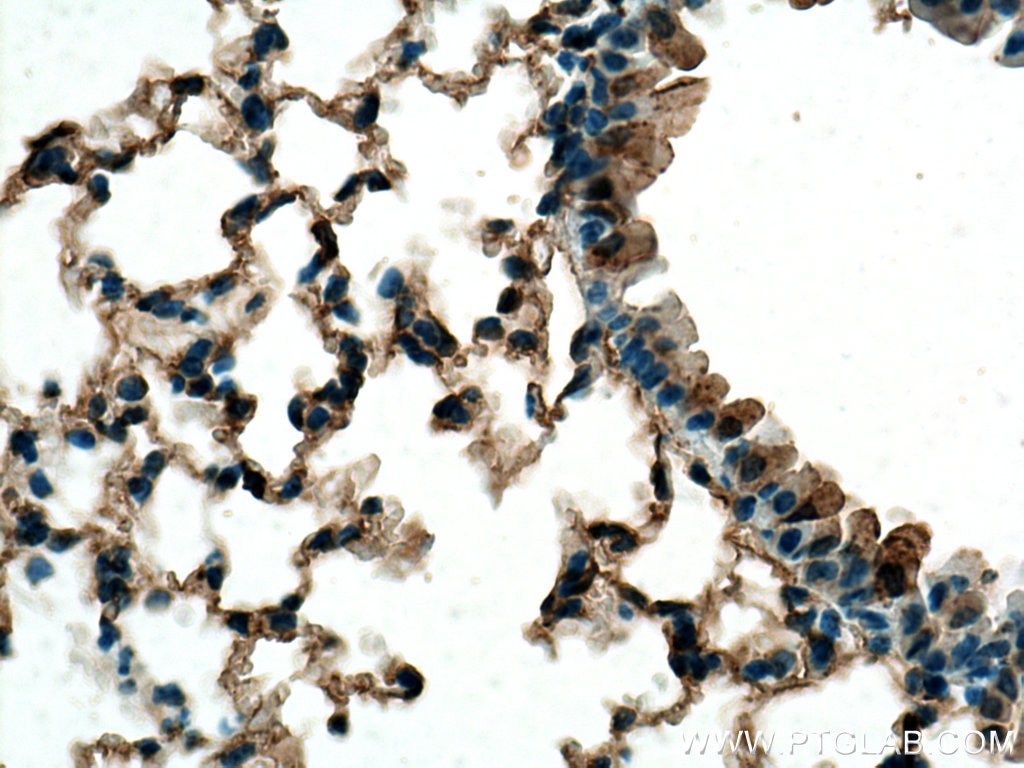Immunohistochemistry (IHC) staining of mouse lung tissue using Beta-2-Microglobulin Polyclonal antibody (13511-1-AP)