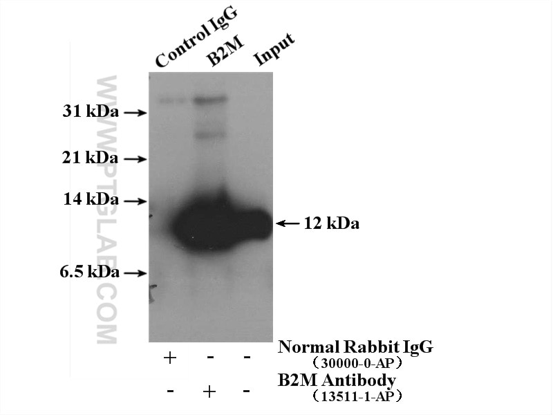 Immunoprecipitation (IP) experiment of A431 cells using Beta-2-Microglobulin Polyclonal antibody (13511-1-AP)