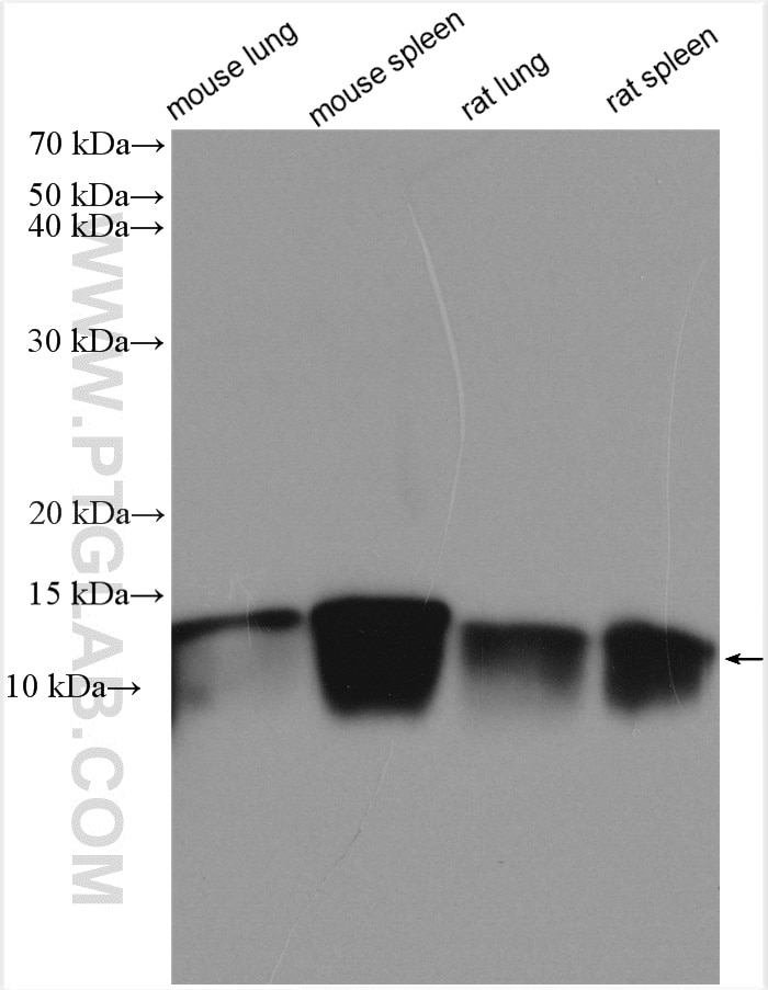 Western Blot (WB) analysis of various lysates using Beta-2-Microglobulin Polyclonal antibody (13511-1-AP)