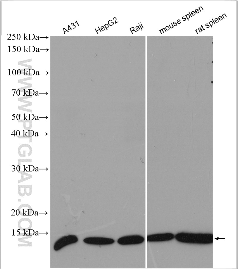 Western Blot (WB) analysis of various lysates using Beta-2-Microglobulin Polyclonal antibody (13511-1-AP)