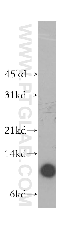 Beta-2-Microglobulin Polyclonal antibody