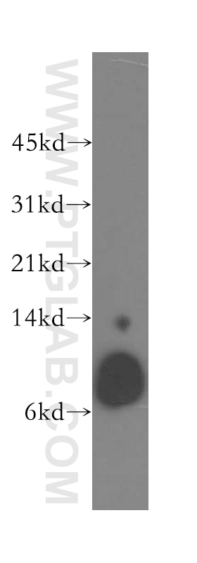 Western Blot (WB) analysis of human heart tissue using Beta-2-Microglobulin Polyclonal antibody (13511-1-AP)