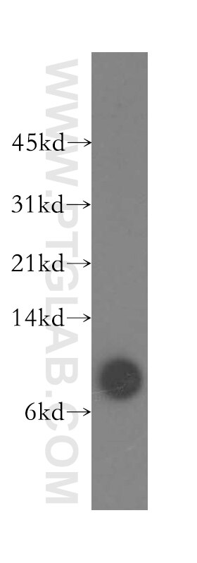 Western Blot (WB) analysis of A431 cells using Beta-2-Microglobulin Polyclonal antibody (13511-1-AP)