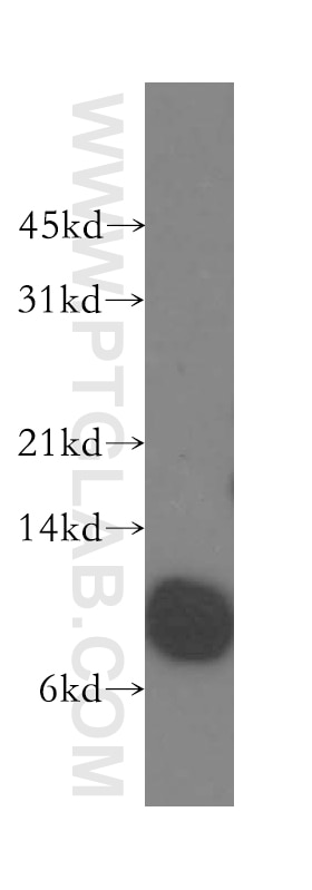 Western Blot (WB) analysis of human stomach tissue using Beta-2-Microglobulin Polyclonal antibody (13511-1-AP)
