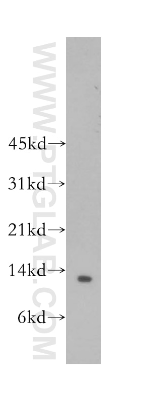 Western Blot (WB) analysis of mouse lung tissue using Beta-2-Microglobulin Polyclonal antibody (13511-1-AP)