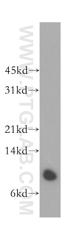 Western Blot (WB) analysis of Raji cells using Beta-2-Microglobulin Polyclonal antibody (13511-1-AP)