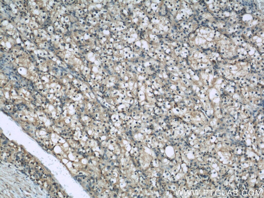 Beta-2-Microglobulin