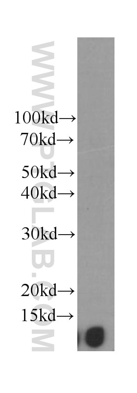 Western Blot (WB) analysis of Raji cells using Beta-2-Microglobulin Monoclonal antibody (66207-1-Ig)