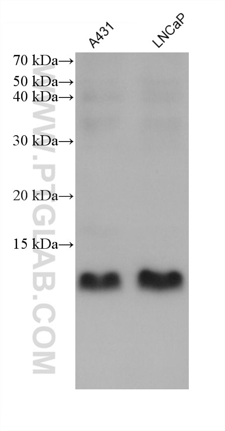 Western Blot (WB) analysis of various lysates using Beta-2-Microglobulin Monoclonal antibody (66207-1-Ig)