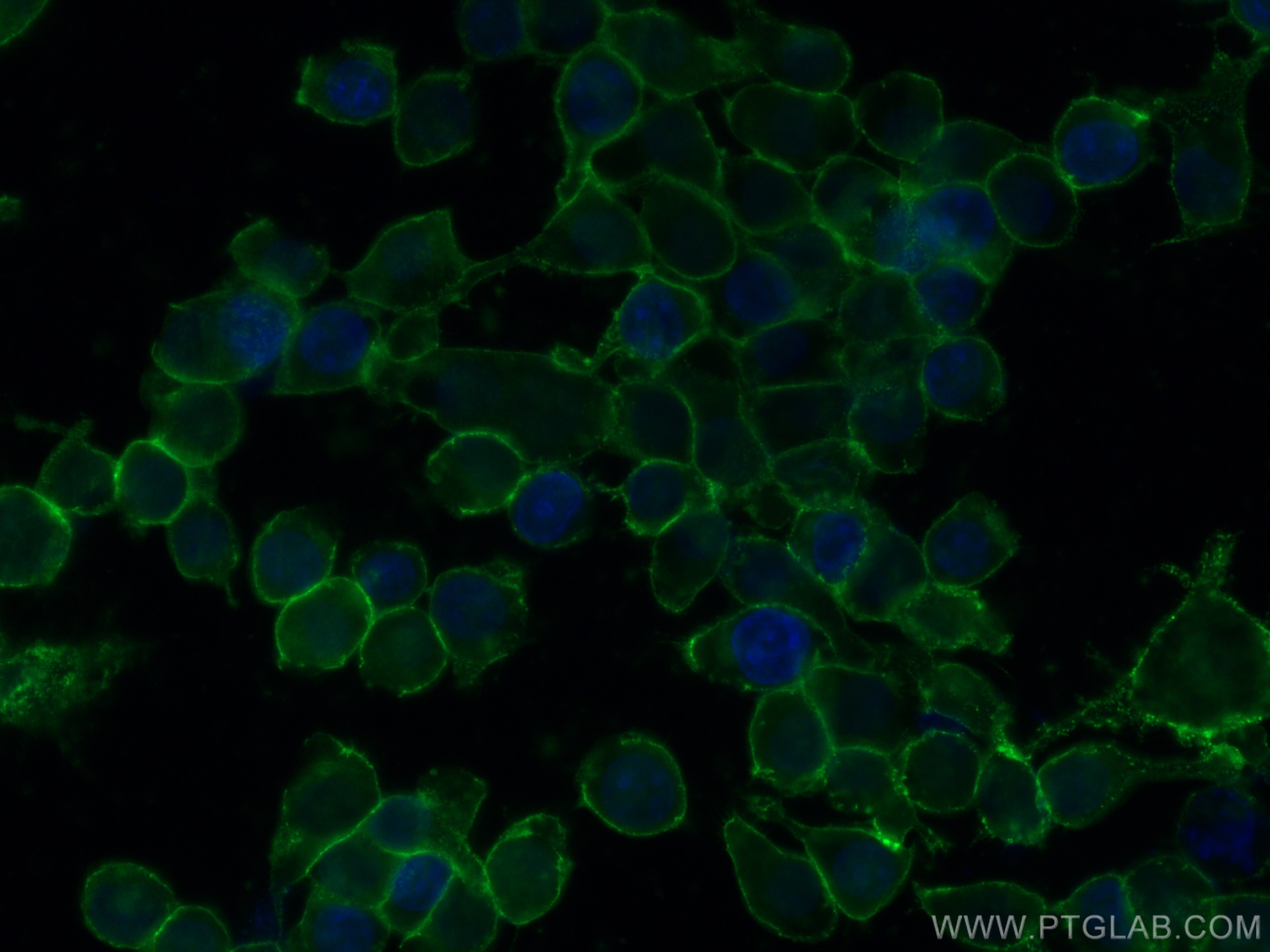 Immunofluorescence (IF) / fluorescent staining of A431 cells using Beta-2-Microglobulin Monoclonal antibody (68395-1-Ig)