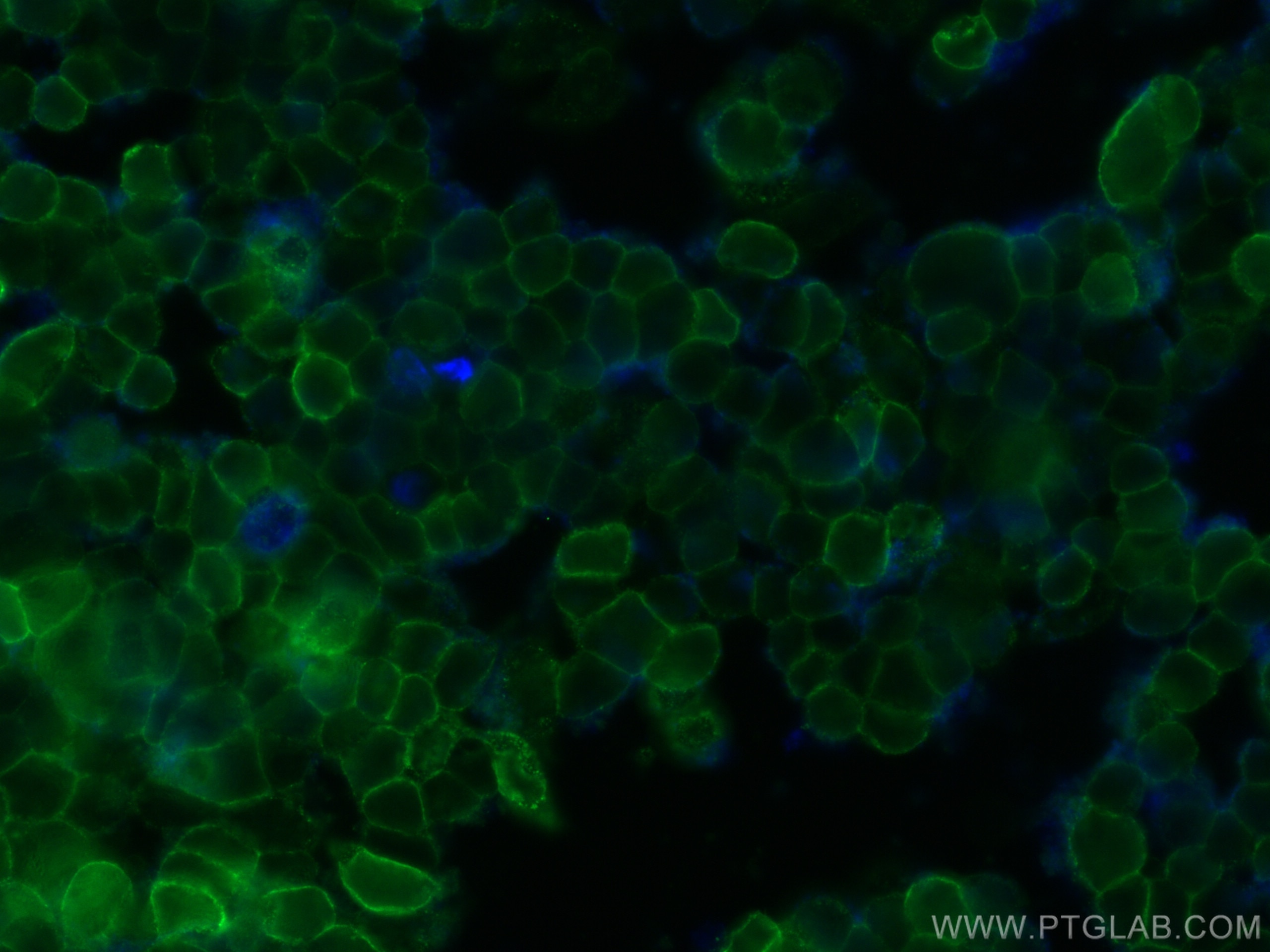Immunofluorescence (IF) / fluorescent staining of NCCIT cells using Beta-2-Microglobulin Monoclonal antibody (68395-1-Ig)