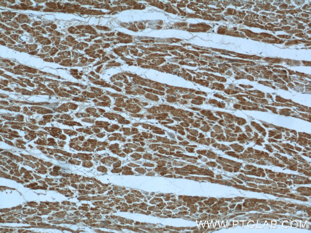Immunohistochemistry (IHC) staining of human heart tissue using B3GALNT1 Polyclonal antibody (22048-1-AP)