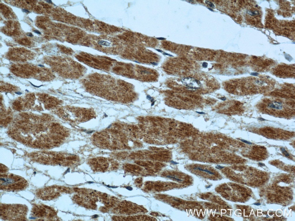 Immunohistochemistry (IHC) staining of human heart tissue using B3GALNT1 Polyclonal antibody (22048-1-AP)