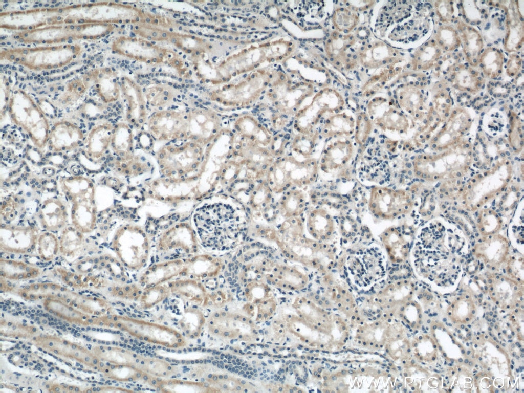 Immunohistochemistry (IHC) staining of human kidney tissue using B3GALNT1 Polyclonal antibody (22048-1-AP)