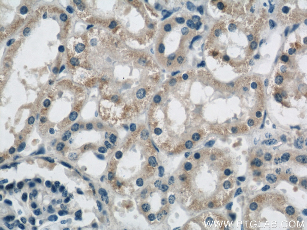 Immunohistochemistry (IHC) staining of human kidney tissue using B3GALNT1 Polyclonal antibody (22048-1-AP)