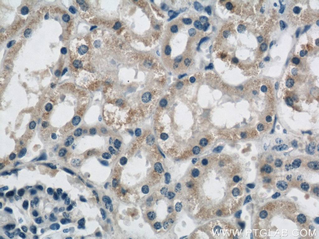 IHC staining of human kidney using 22048-1-AP