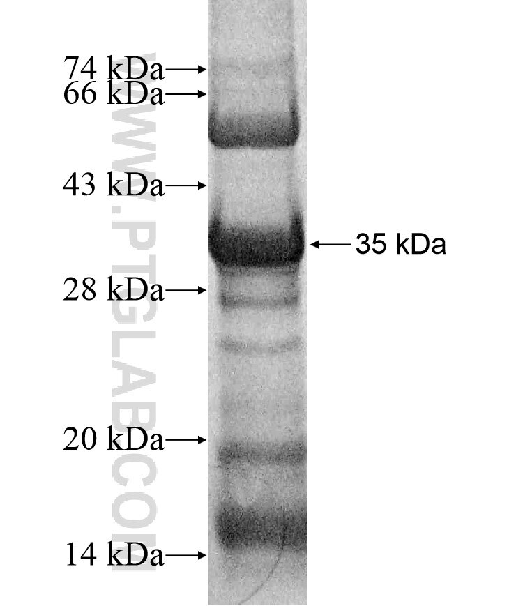 B3GALNT1 fusion protein Ag16976 SDS-PAGE