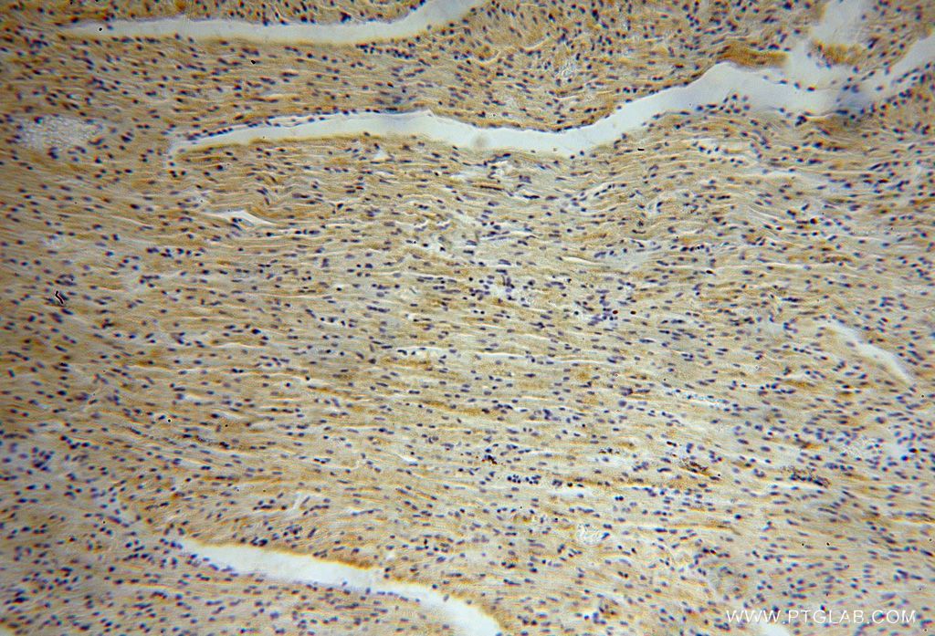 Immunohistochemistry (IHC) staining of human heart tissue using B3GALNT2 Polyclonal antibody (17142-1-AP)