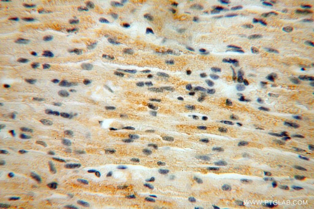 IHC staining of human heart using 17142-1-AP