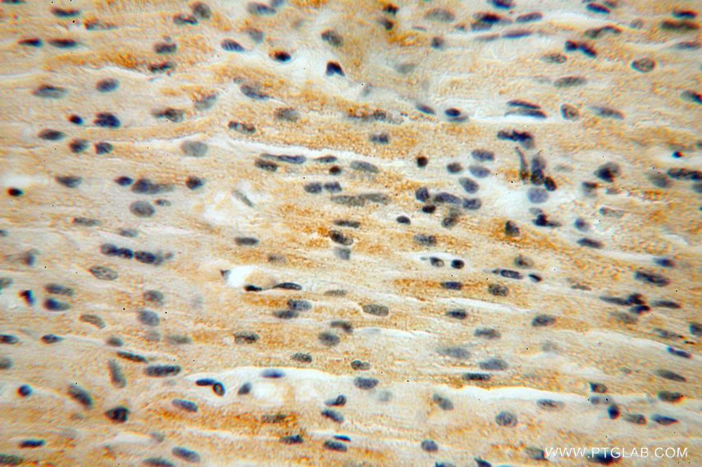 Immunohistochemistry (IHC) staining of human heart tissue using B3GALNT2 Polyclonal antibody (17142-1-AP)