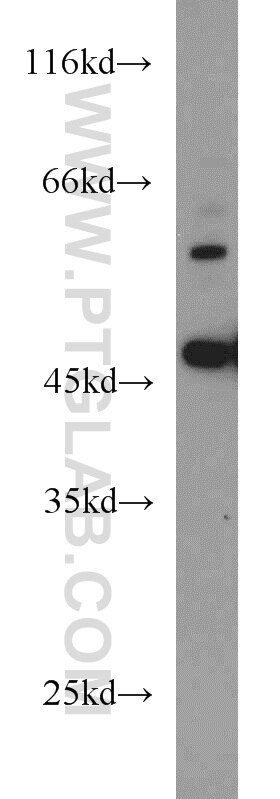 Western Blot (WB) analysis of HEK-293 cells using B3GALNT2 Polyclonal antibody (17142-1-AP)