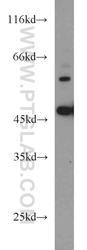 Western Blot (WB) analysis of HEK-293 cells using B3GALNT2 Polyclonal antibody (17142-1-AP)