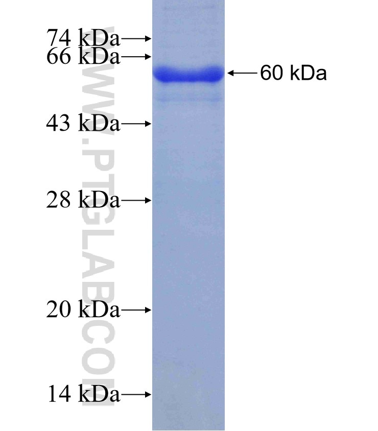 B3GALNT2 fusion protein Ag10907 SDS-PAGE
