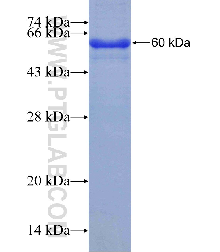 B3GALNT2 fusion protein Ag10907 SDS-PAGE