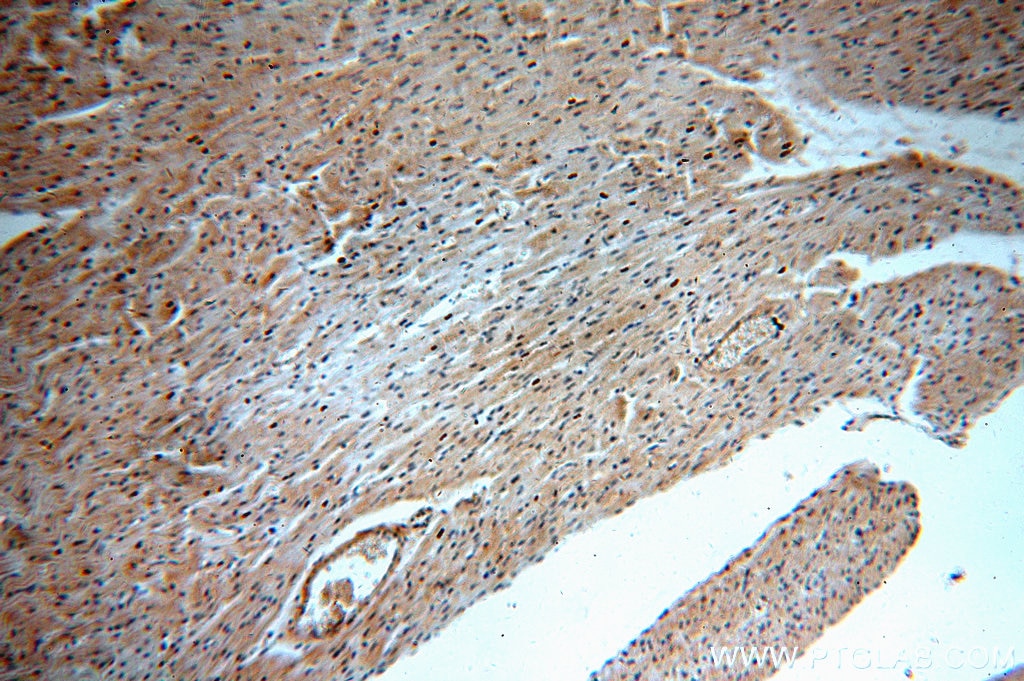 Immunohistochemistry (IHC) staining of human heart tissue using B3GALT2 Polyclonal antibody (14177-1-AP)