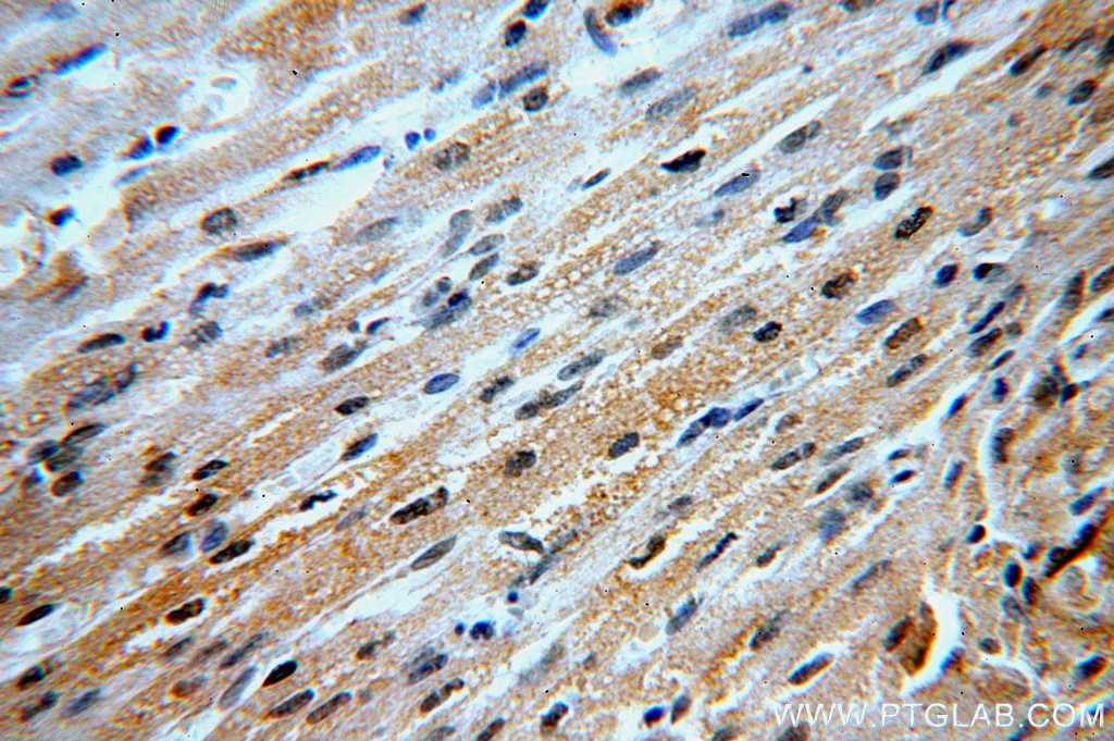 Immunohistochemistry (IHC) staining of human heart tissue using B3GALT2 Polyclonal antibody (14177-1-AP)