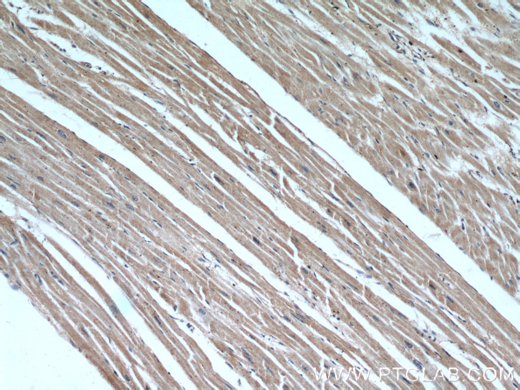 Immunohistochemistry (IHC) staining of human heart tissue using B3GALT2 Polyclonal antibody (14177-1-AP)