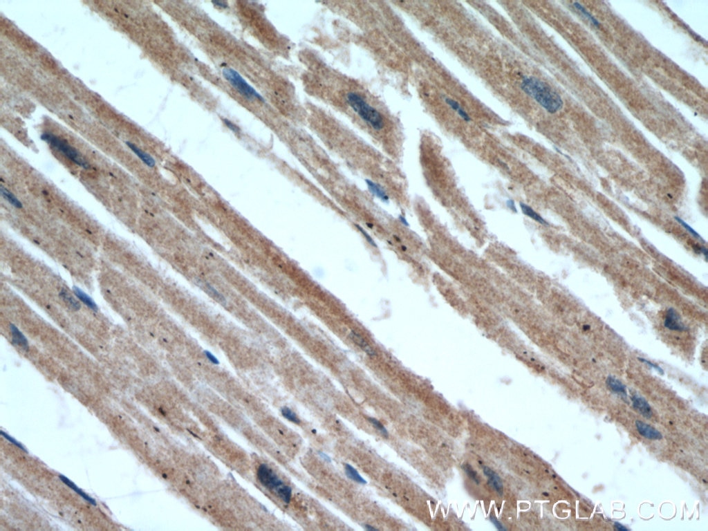 IHC staining of human heart using 14177-1-AP